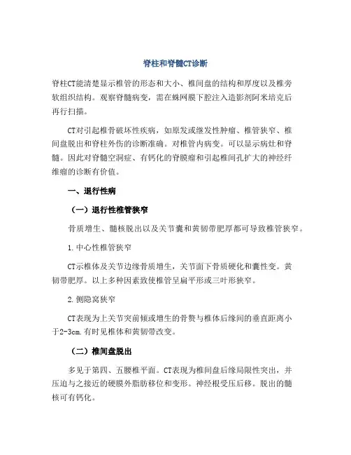 脊柱和脊髓CT诊断