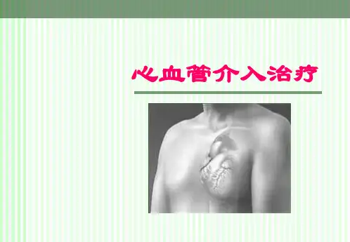 心血管介入治疗ppt课件