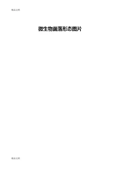 最新微生物菌落特征形态等总结大全(表格带图片)