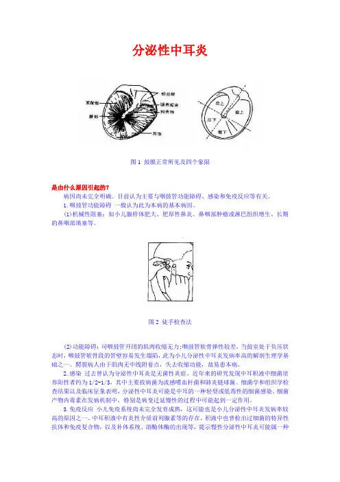 分泌性中耳炎 2
