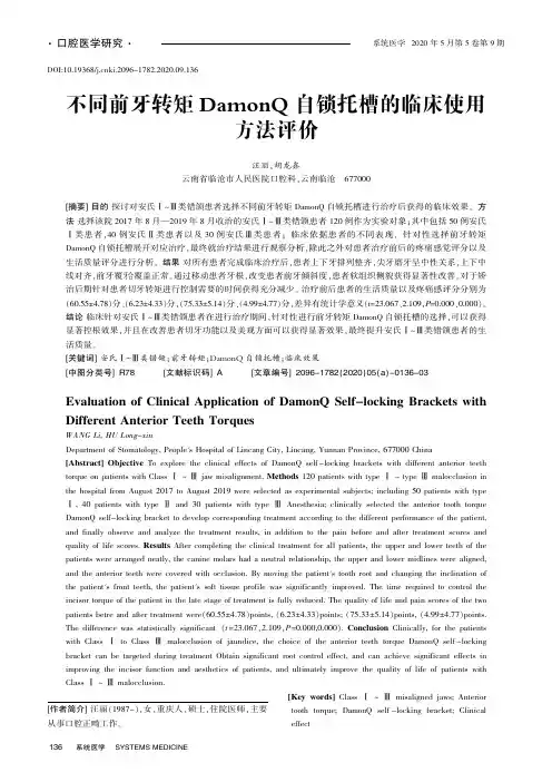 不同前牙转矩DamonQ自锁托槽的临床使用方法评价