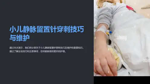 小儿静脉留置针穿刺技巧与维护