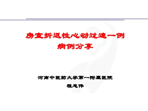 房室折返性心动过速一例病例分享