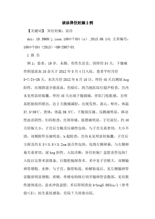 误诊异位妊娠2例论文
