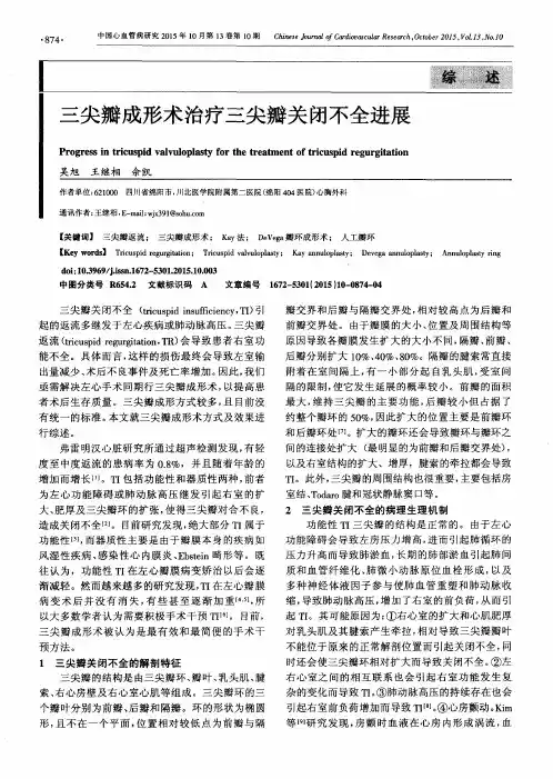 三尖瓣成形术治疗三尖瓣关闭不全进展