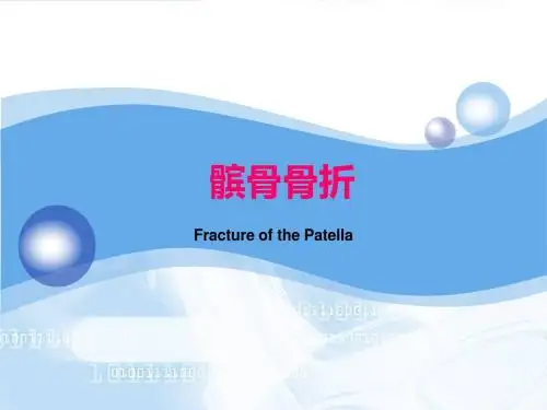 髌骨骨折的治疗ppt课件