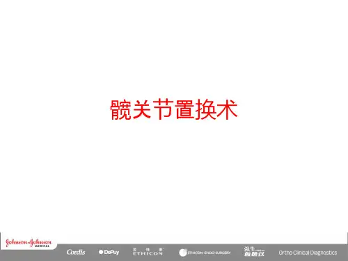 髋关节置换术