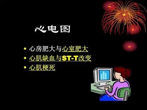 心电图第3、4、5节