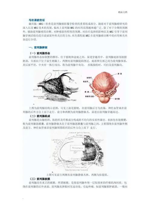 前列腺MRI