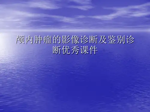 颅内肿瘤的影像诊断及鉴别诊断优秀课件