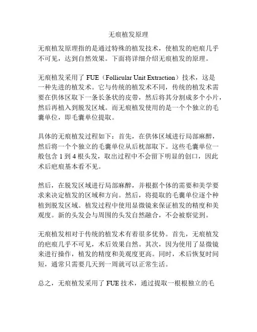 无痕植发原理