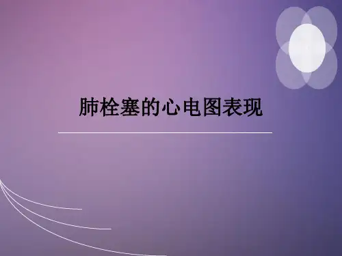 肺栓塞的心电图表现ppt课件