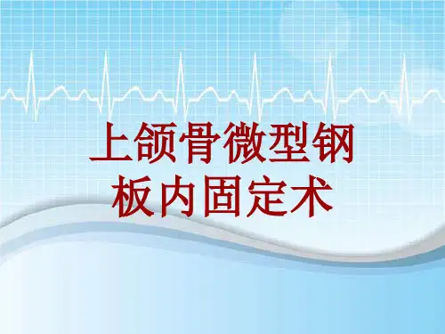 手术讲解模板：上颌骨微型钢板内固定术