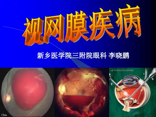 U737-眼科学-视网膜病2