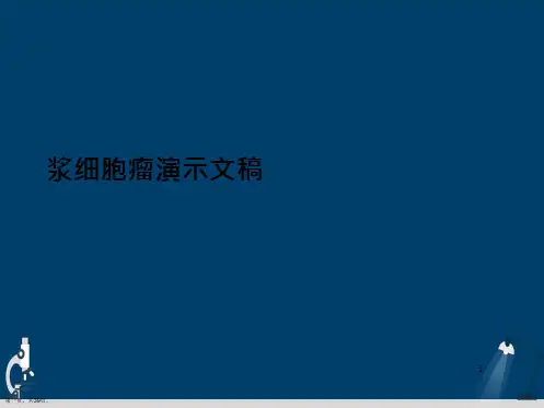 浆细胞瘤演示文稿