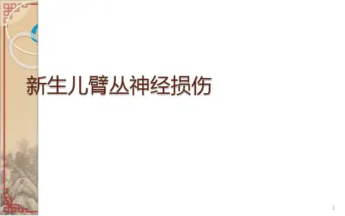 新生儿臂丛神经损伤ppt课件