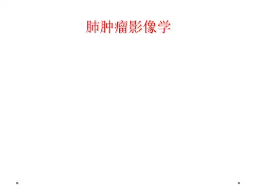肺肿瘤影像学