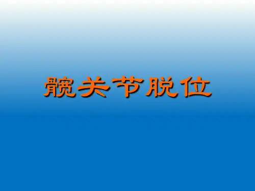 髋关节脱位ppt课件