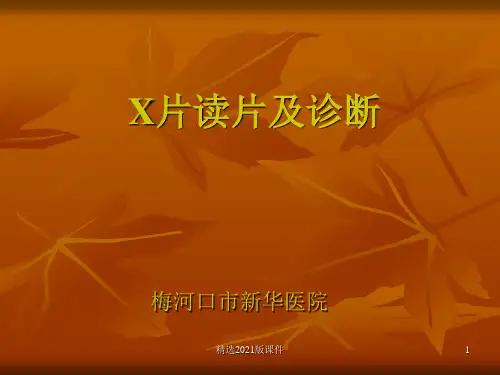 常见X片读片及诊断