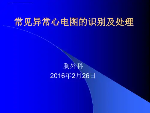 常见异常心电图识别及处理知识课件