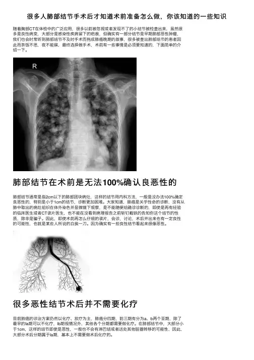 很多人肺部结节手术后才知道术前准备怎么做，你该知道的一些知识