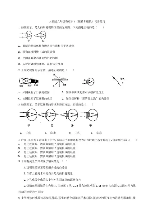 人教版八年级物理5.4(眼睛和眼镜)同步练习  含答案