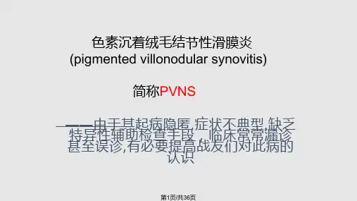 色素沉着绒毛结节性滑膜炎的诊治PPT课件
