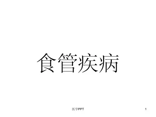 《食管疾病》PPT课件