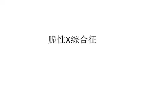 脆性X综合征