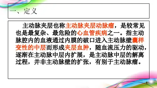主动脉夹层护理查房优秀课件