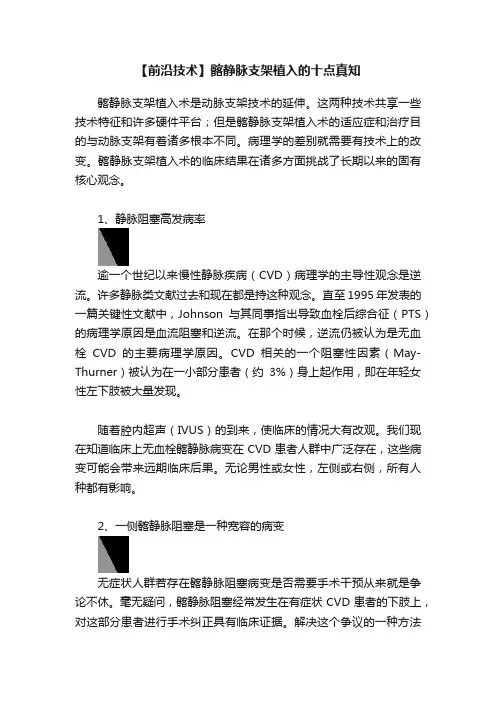 【前沿技术】髂静脉支架植入的十点真知