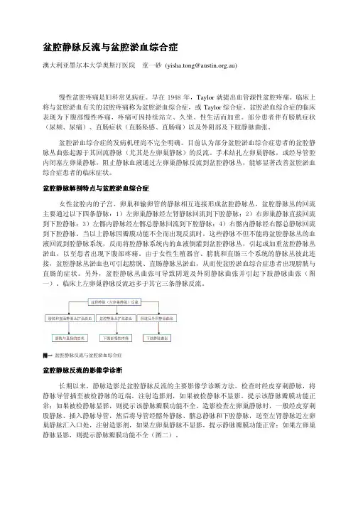 盆腔淤血综合症