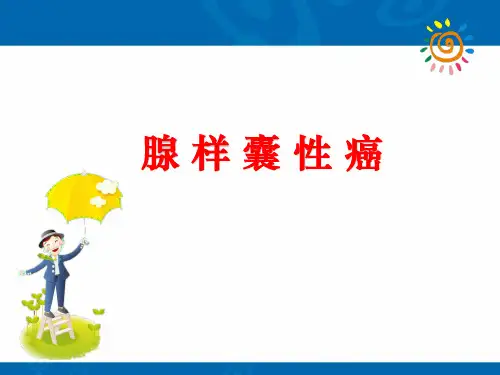 腺样囊性癌ppt课件