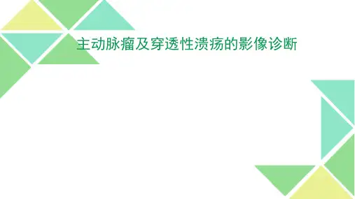主动脉瘤及穿透性溃疡的影像诊断ppt课件