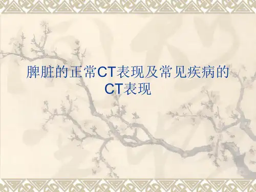 脾脏的正常与异常CT表现