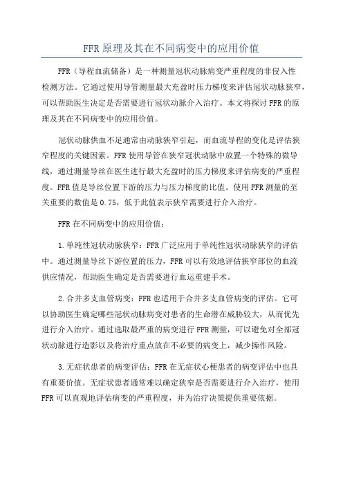 FFR原理及其在不同病变中的应用价值