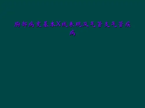 胸部病变基本X线表现及气管支气管疾病