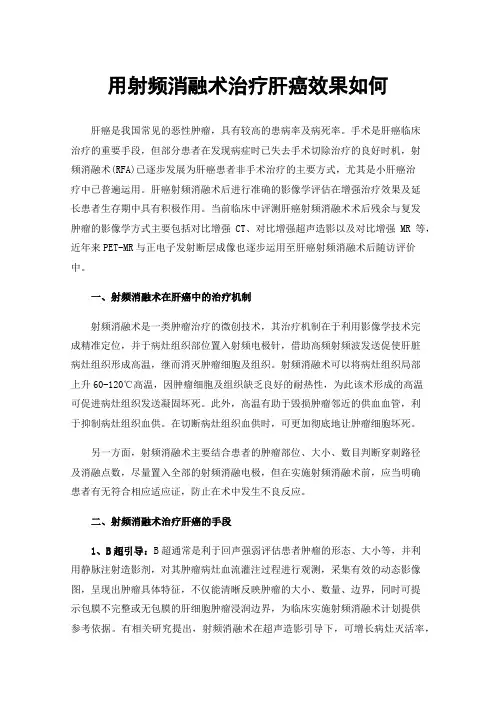 用射频消融术治疗肝癌效果如何