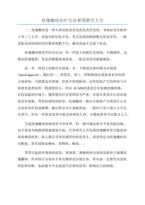 玫瑰糠疹治疗方法要领教学大全