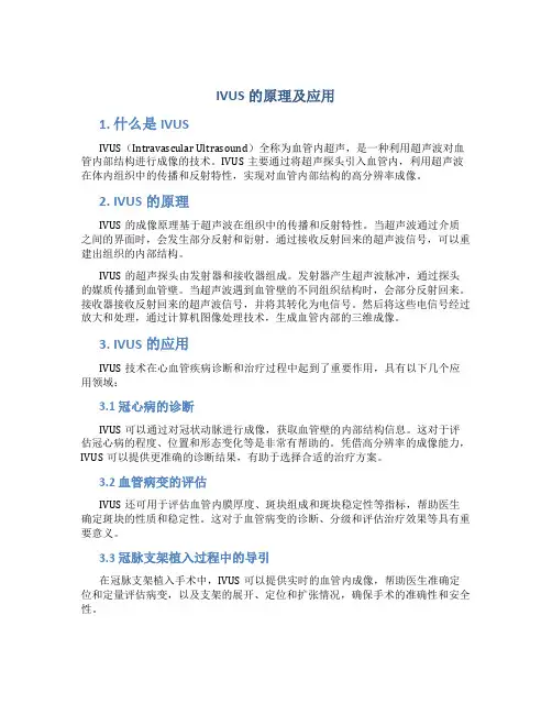 ivus的原理及应用