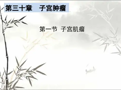 子宫肌瘤 PPT课件