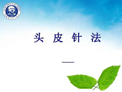 头皮针法