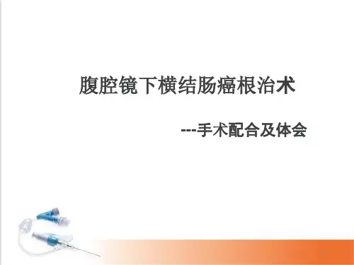 (医学课件)腹腔镜下横结肠癌根治术手术配合及体会PPT幻灯片