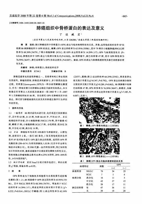 肺癌组织中骨桥蛋白的表达及意义