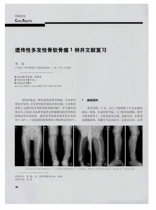 遗传性多发性骨软骨瘤1例并文献复习