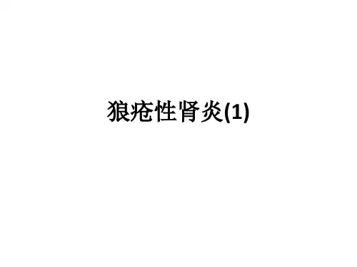 狼疮性肾炎(1)ppt课件