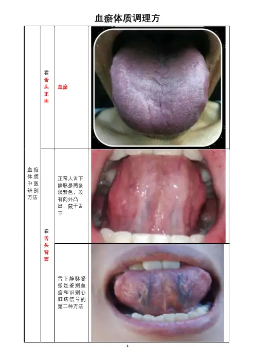 血瘀体质调理方