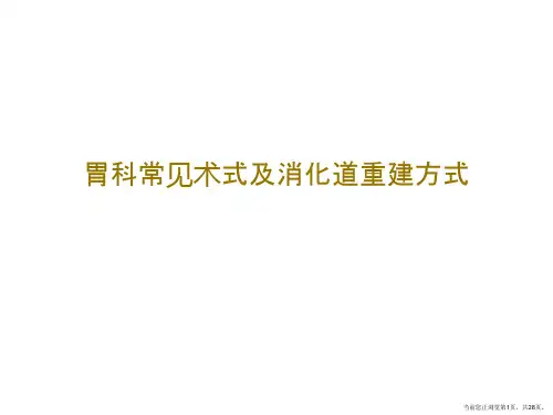 胃科常见术式及消化道重建方式