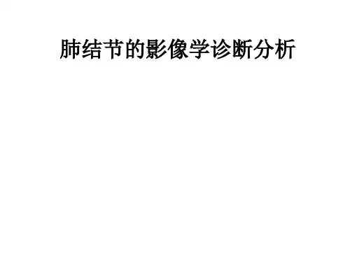 肺结节的影像学诊断分析PPT课件