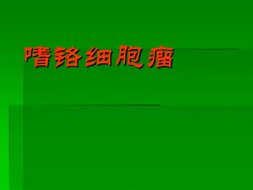 嗜铬细胞瘤